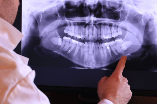 Best Emergency Dentist for Lost Fillings or Crowns in Premont, TX