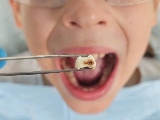 Best Pediatric Emergency Dentist in Premont, TX